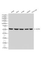 NUP85 Recombinant monoclonal antibody Proteintech  83288-2-RR