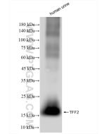 TFF2 Recombinant monoclonal antibody Proteintech  83717-4-RR
