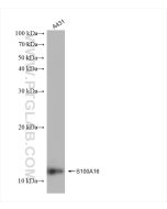 S100A16 Recombinant monoclonal antibody Proteintech  82923-1-RR