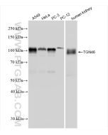 TGN46 Recombinant monoclonal antibody Proteintech  83099-2-RR