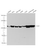 OGT Recombinant monoclonal antibody Proteintech  83113-1-RR