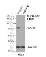 Calpain 1 Polyclonal antibody Proteintech  10538-1-AP