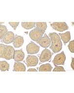 Osteocalcin/OCN Polyclonal antibody Proteintech  23418-1-AP