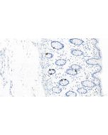 Anti-Human Chromogranin A Rabbit Recombinant Antibody Proteintech  98570-1-RR