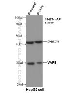 VAPB Polyclonal antibody Proteintech  14477-1-AP