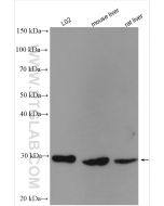 NNMT Polyclonal antibody Proteintech  15123-1-AP