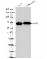 OPTN/Optineurin Recombinant monoclonal antibody Proteintech  83634-5-RR