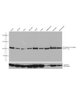 PI3 Kinase p110 Alpha Monoclonal antibody Proteintech  67071-1-Ig