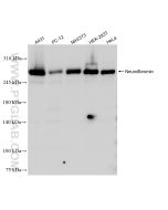 Neurofibromin Recombinant monoclonal antibody Proteintech  83620-5-RR