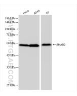 SMAD2 Recombinant monoclonal antibody Proteintech  83841-4-RR