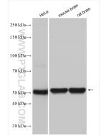 Beta Tubulin Polyclonal antibody Proteintech  10068-1-AP