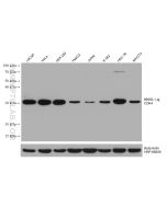 CDK4 Monoclonal antibody Proteintech  66950-1-Ig