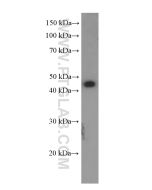 GLUT1 Monoclonal antibody Proteintech  66290-1-Ig