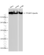 TP53BP1-Specific Recombinant monoclonal antibody Proteintech  83809-1-RR