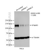 IFNAR1 Recombinant monoclonal antibody Proteintech  83002-4-RR