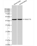 KIAA1715 Recombinant monoclonal antibody Proteintech  83418-4-RR