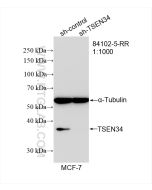 TSEN34 Recombinant monoclonal antibody Proteintech  84102-5-RR