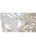 Anti-Human CD45RO (UCHL1) Proteintech  65150-1-Ig