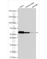 calreticulin Polyclonal antibody Proteintech  27298-1-AP