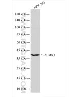 ACMSD Recombinant monoclonal antibody Proteintech  84100-3-RR