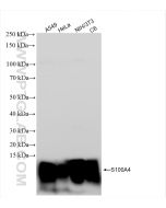 S100A4 Recombinant monoclonal antibody Proteintech  84221-1-RR