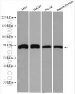 p63 Polyclonal antibody Proteintech  12143-1-AP