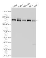 GOLGA2/GM130 Polyclonal antibody Proteintech  11308-1-AP