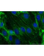 Anti-Mouse CD31 (390) Proteintech  65058-1-Ig