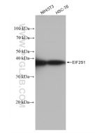 EIF2S1 Recombinant monoclonal antibody Proteintech  82936-1-RR
