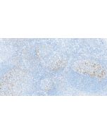 Anti-Human PD-1/CD279 Rabbit Recombinant Antibody Proteintech  98068-1-RR