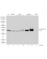 JUN Polyclonal antibody Proteintech  24909-1-AP