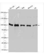 EZH2 Polyclonal antibody Proteintech  21800-1-AP