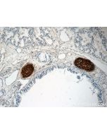 Aggrecan Polyclonal antibody Proteintech  13880-1-AP