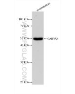 GABRA2 Recombinant monoclonal antibody Proteintech  83057-2-RR