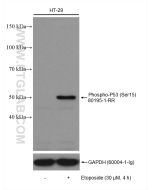 Phospho-P53 (Ser15) Recombinant monoclonal antibody Proteintech  80195-1-RR