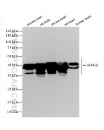 NDRG2 Recombinant monoclonal antibody Proteintech  83902-7-RR