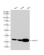 AGPAT2 Recombinant monoclonal antibody Proteintech  83349-3-RR