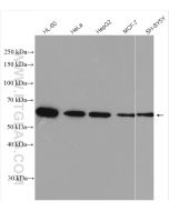 calreticulin Polyclonal antibody Proteintech  10292-1-AP