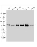 Cortactin Polyclonal antibody Proteintech  11381-1-AP