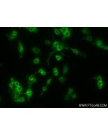 Anti-Mouse CD14 Rabbit Recombinant Antibody Proteintech  98020-1-RR