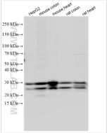 RBPMS Polyclonal antibody Proteintech  15187-1-AP