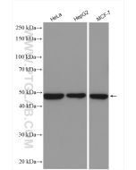 Ribosomal protein L4 Polyclonal antibody Proteintech  11302-1-AP
