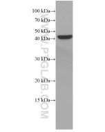 VEGFA Monoclonal antibody Proteintech  66828-1-Ig