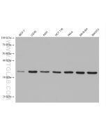Cyclin D1 Monoclonal antibody Proteintech  60186-1-Ig