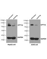 CPT1A Polyclonal antibody Proteintech  15184-1-AP