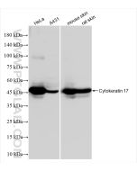 Cytokeratin 17-specific Recombinant monoclonal antibody Proteintech  84978-1-RR