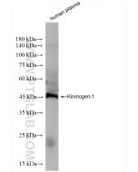 Kininogen 1 Recombinant monoclonal antibody Proteintech  84175-5-RR