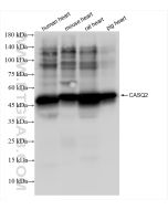 Calsequestrin 2 Recombinant monoclonal antibody Proteintech  84056-6-RR