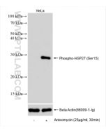 Phospho-HSP27 (Ser15) Recombinant monoclonal antibody Proteintech  83332-3-RR