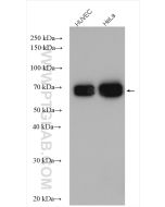 Lamin A/C Polyclonal antibody Proteintech  10298-1-AP